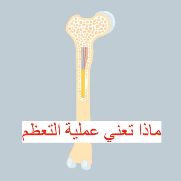 ماذا تعني عملية التعظم