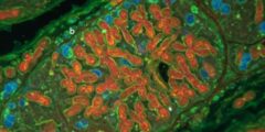 ماذا يعني مفهوم تعدد المجموعة الكروموسومية polyploidy