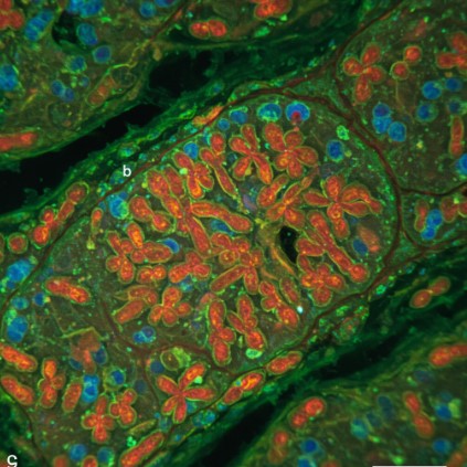 ماذا يعني مفهوم تعدد المجموعة الكروموسومية polyploidy