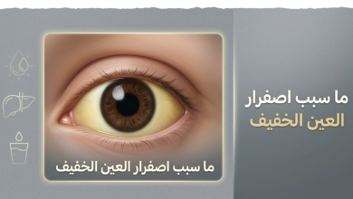 ما سبب اصفرار العين الخفيف